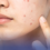 ALAMIN ANG MGA SENYALES NG STRESSED SKIN