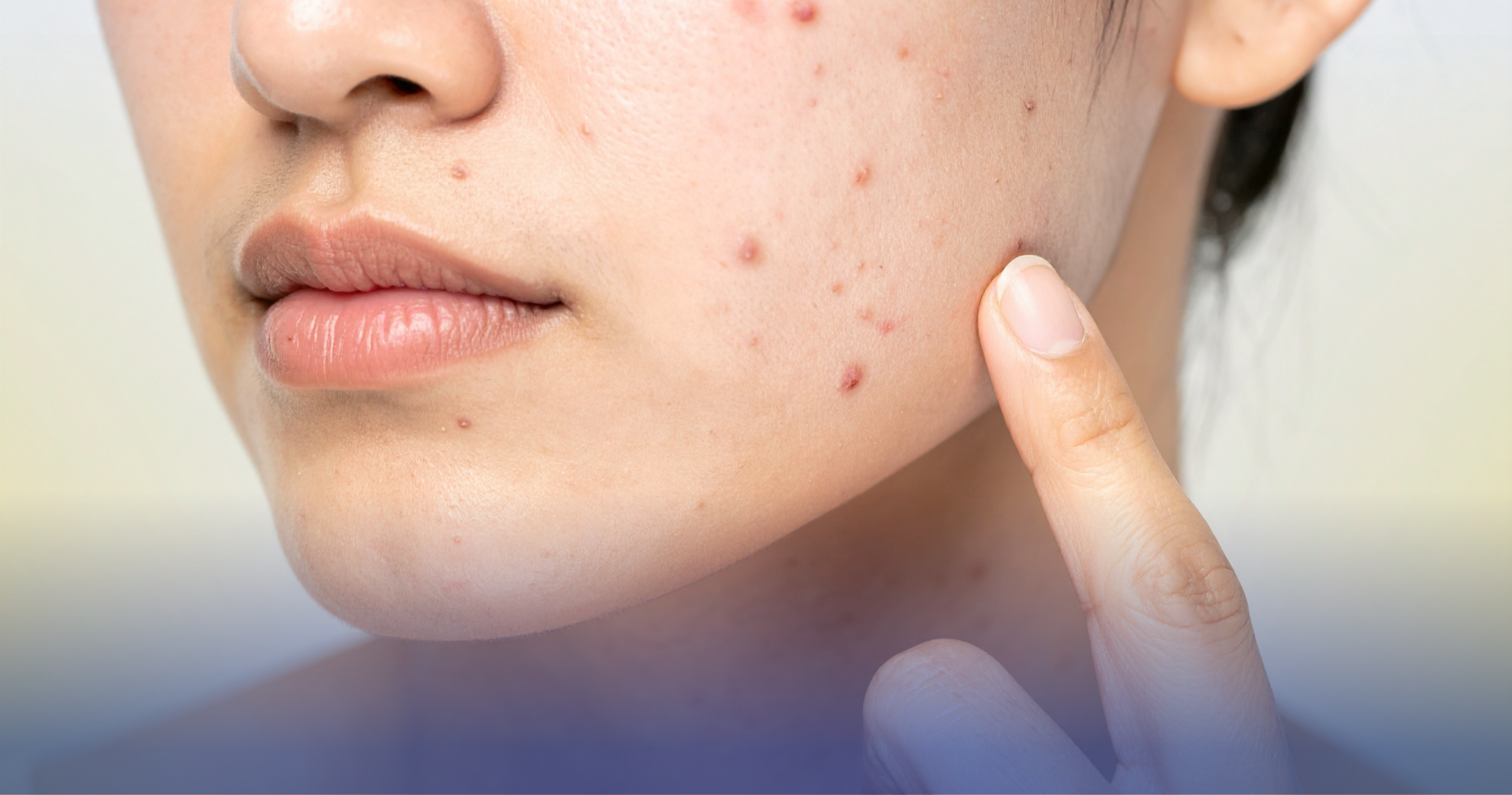 ALAMIN ANG MGA SENYALES NG STRESSED SKIN