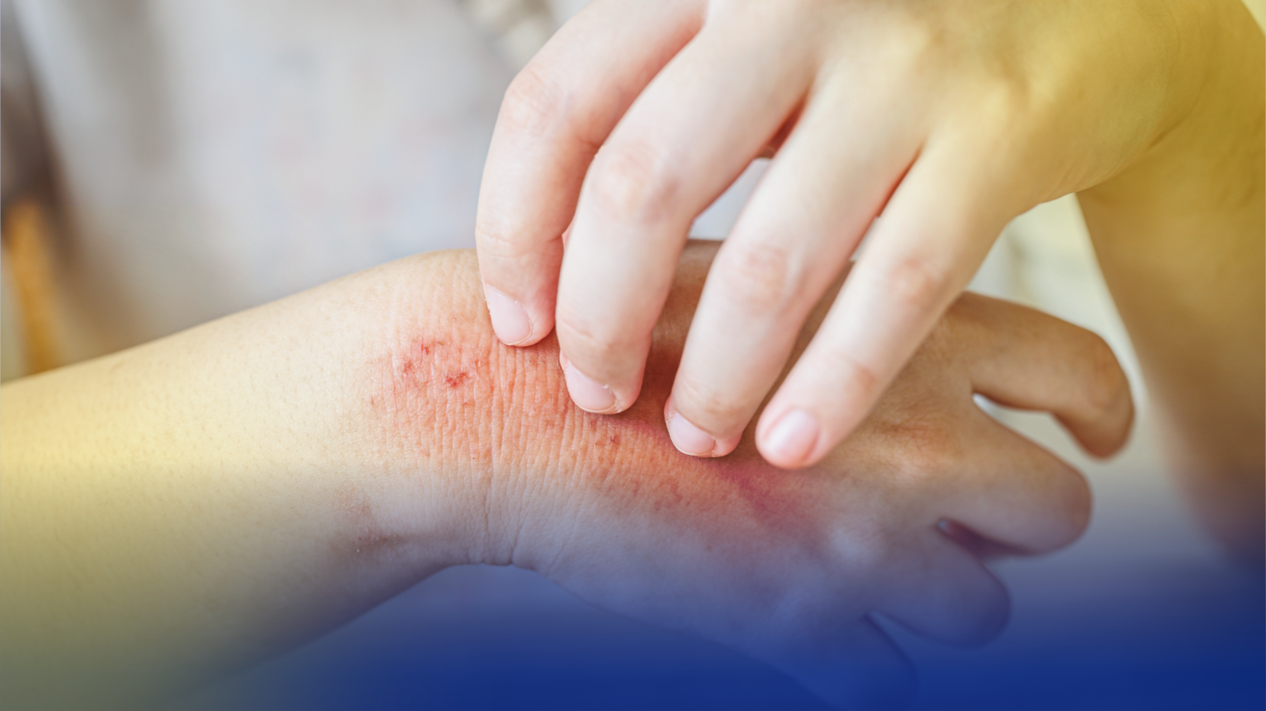 ALAMIN KUNG BAKIT HINDI DAPAT IPAGSAWALANG BAHALA ANG FUNGAL INFECTION